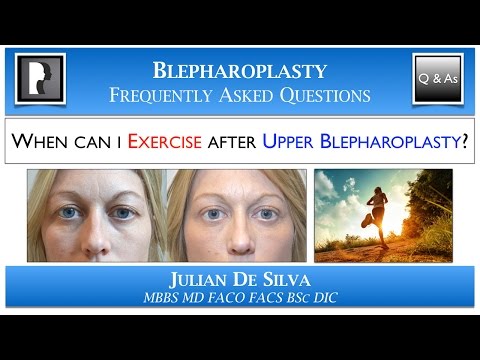 When can I EXERCISE after Upper Blepharoplasty? When can I go Running or do Yoga?